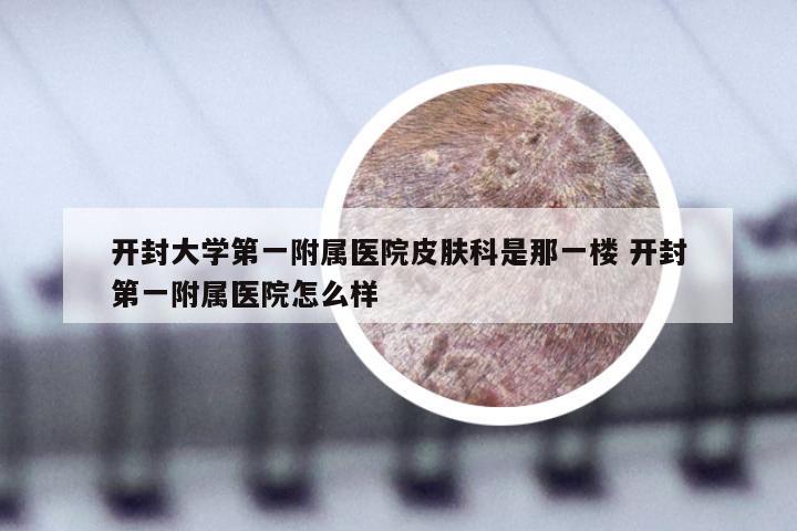 开封大学第一附属医院皮肤科是那一楼 开封第一附属医院怎么样