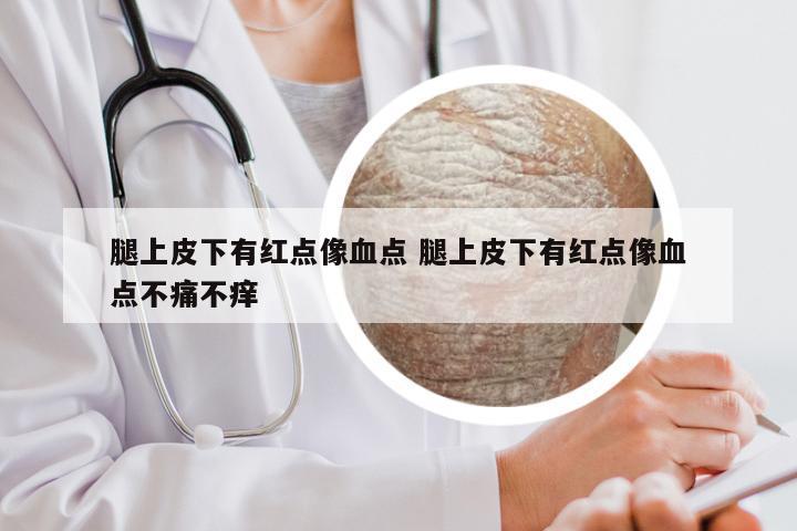 腿上皮下有红点像血点 腿上皮下有红点像血点不痛不痒