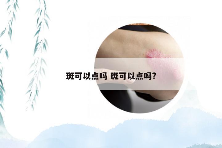 斑可以点吗 斑可以点吗?