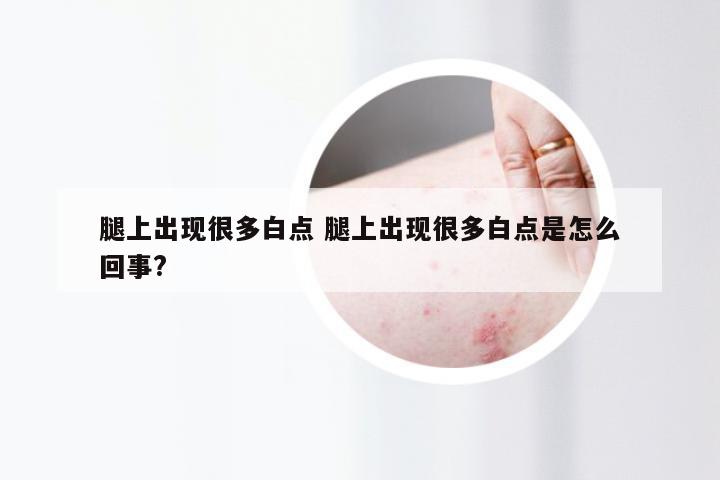 腿上出现很多白点 腿上出现很多白点是怎么回事?