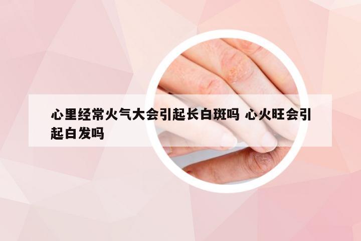 心里经常火气大会引起长白斑吗 心火旺会引起白发吗