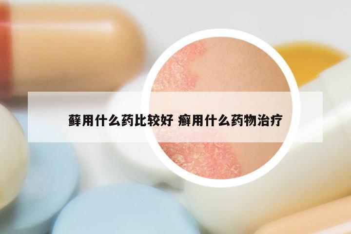 藓用什么药比较好 癣用什么药物治疗