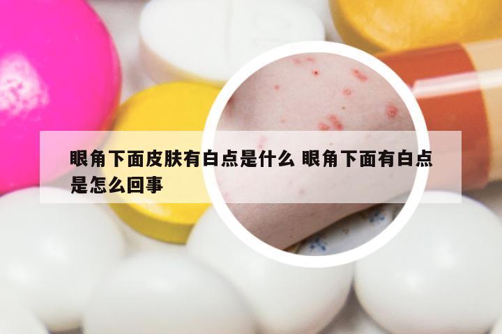 眼角下面皮肤有白点是什么 眼角下面有白点是怎么回事