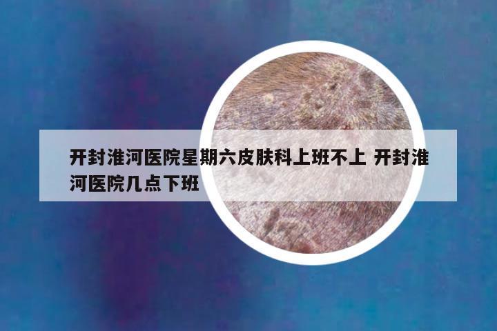 开封淮河医院星期六皮肤科上班不上 开封淮河医院几点下班