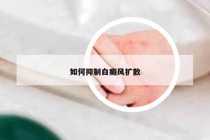 如何抑制白癜风扩散