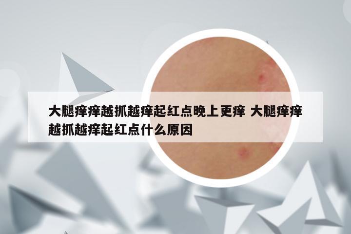 大腿痒痒越抓越痒起红点晚上更痒 大腿痒痒越抓越痒起红点什么原因