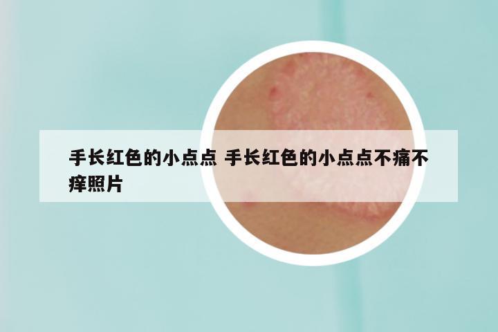 手长红色的小点点 手长红色的小点点不痛不痒照片