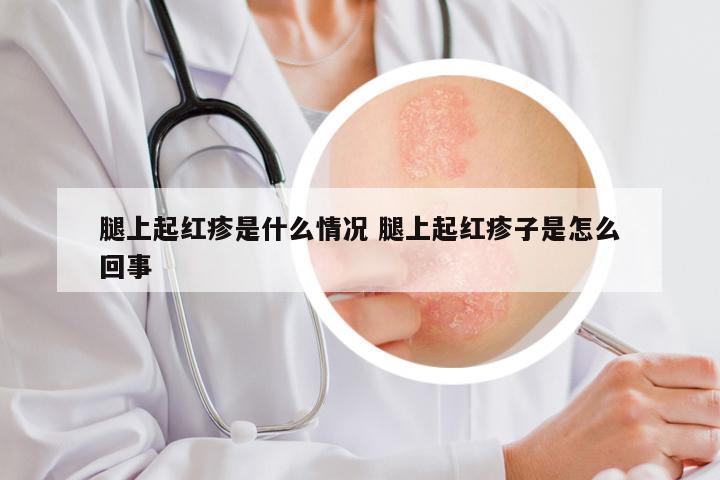 腿上起红疹是什么情况 腿上起红疹子是怎么回事