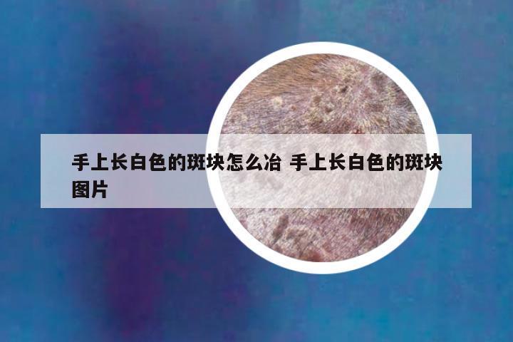 手上长白色的斑块怎么冶 手上长白色的斑块图片