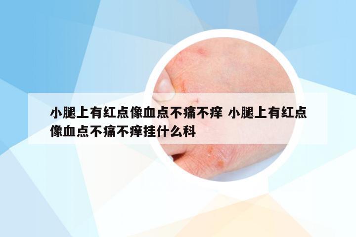 小腿上有红点像血点不痛不痒 小腿上有红点像血点不痛不痒挂什么科