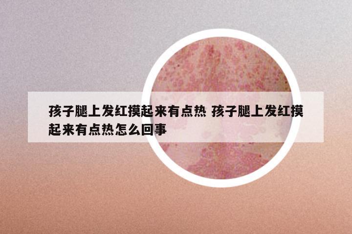 孩子腿上发红摸起来有点热 孩子腿上发红摸起来有点热怎么回事