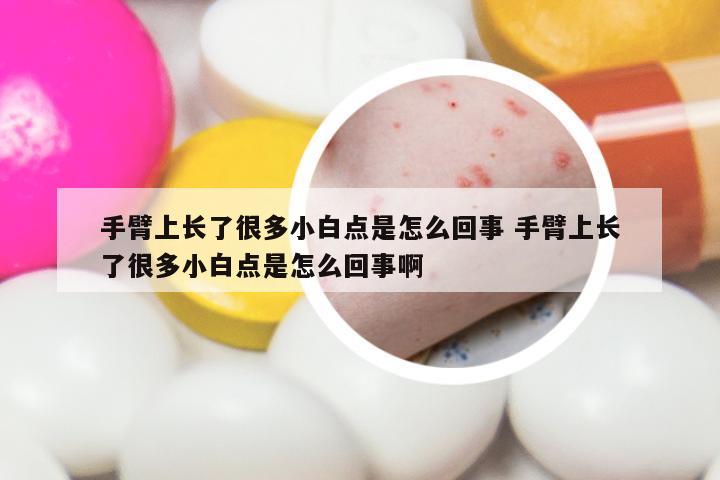 手臂上长了很多小白点是怎么回事 手臂上长了很多小白点是怎么回事啊