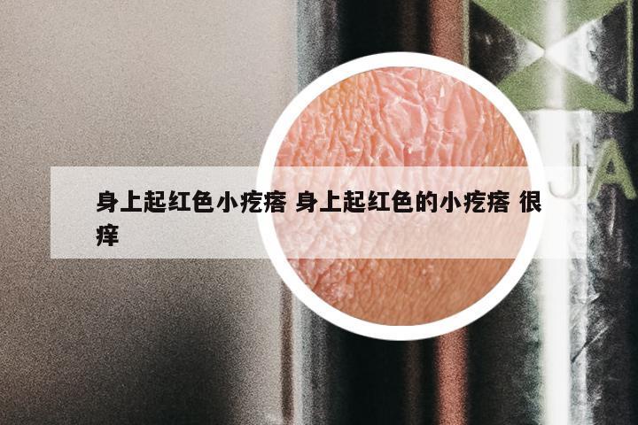 身上起红色小疙瘩 身上起红色的小疙瘩 很痒