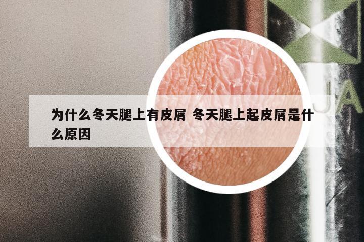 为什么冬天腿上有皮屑 冬天腿上起皮屑是什么原因