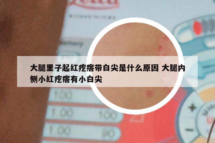 大腿里子起红疙瘩带白尖是什么原因 大腿内侧小红疙瘩有小白尖