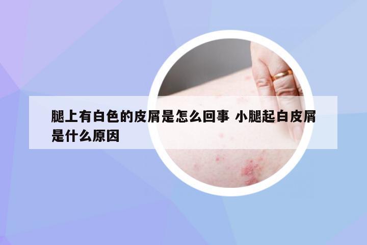 腿上有白色的皮屑是怎么回事 小腿起白皮屑是什么原因