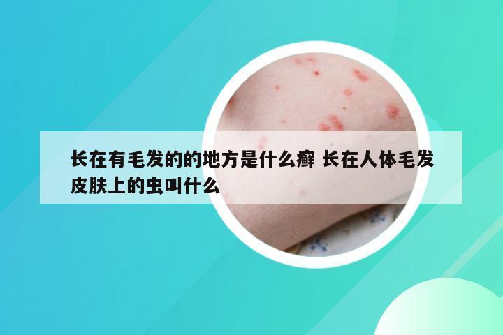 长在有毛发的的地方是什么癣 长在人体毛发皮肤上的虫叫什么