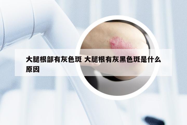 大腿根部有灰色斑 大腿根有灰黑色斑是什么原因