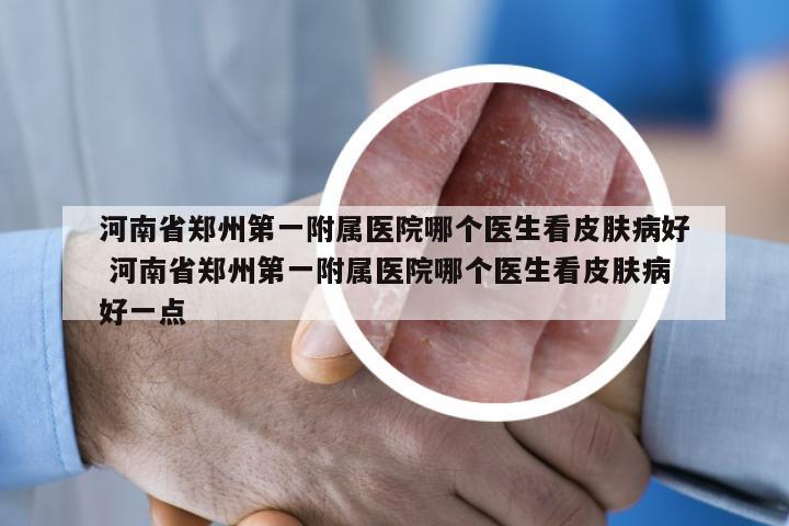 河南省郑州第一附属医院哪个医生看皮肤病好 河南省郑州第一附属医院哪个医生看皮肤病好一点