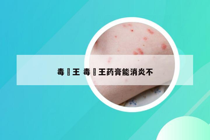 毒廯王 毒廯王药膏能消炎不