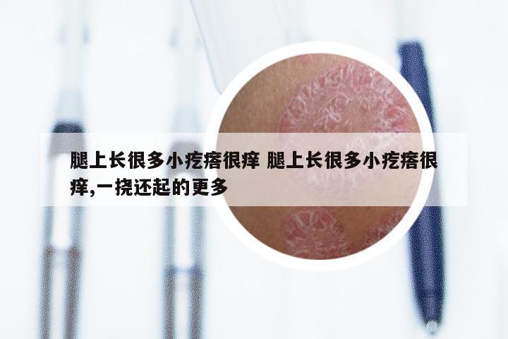 腿上长很多小疙瘩很痒 腿上长很多小疙瘩很痒,一挠还起的更多