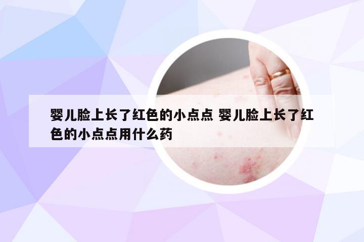 婴儿脸上长了红色的小点点 婴儿脸上长了红色的小点点用什么药