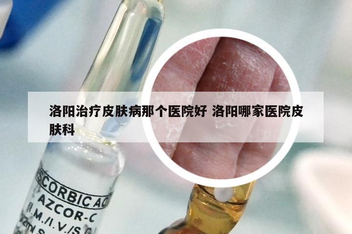 洛阳治疗皮肤病那个医院好 洛阳哪家医院皮肤科