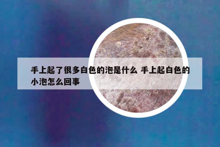 手上起了很多白色的泡是什么 手上起白色的小泡怎么回事