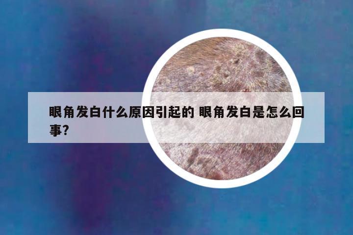 眼角发白什么原因引起的 眼角发白是怎么回事?