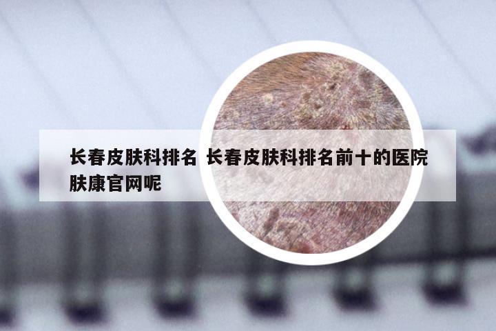 长春皮肤科排名 长春皮肤科排名前十的医院肤康官网呢