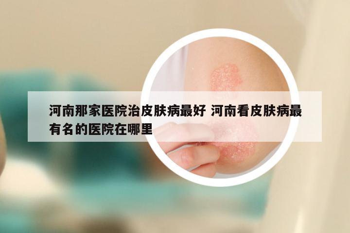 河南那家医院治皮肤病最好 河南看皮肤病最有名的医院在哪里