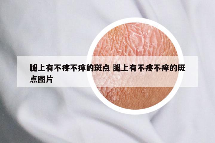 腿上有不疼不痒的斑点 腿上有不疼不痒的斑点图片