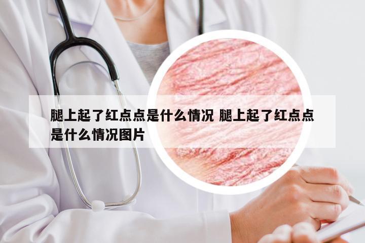 腿上起了红点点是什么情况 腿上起了红点点是什么情况图片