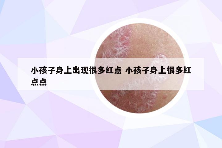 小孩子身上出现很多红点 小孩子身上很多红点点