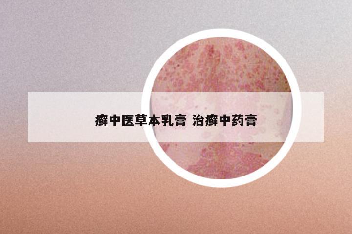 癣中医草本乳膏 治癣中药膏