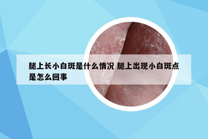 腿上长小白斑是什么情况 腿上出现小白斑点是怎么回事