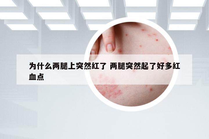 为什么两腿上突然红了 两腿突然起了好多红血点