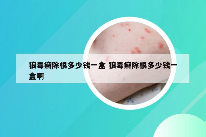 狼毒癣除根多少钱一盒 狼毒癣除根多少钱一盒啊