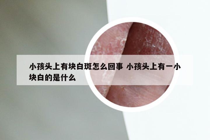 小孩头上有块白斑怎么回事 小孩头上有一小块白的是什么