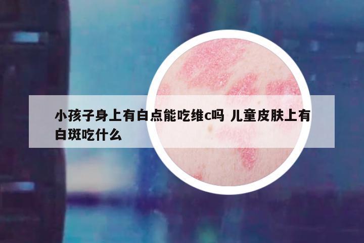 小孩子身上有白点能吃维c吗 儿童皮肤上有白斑吃什么