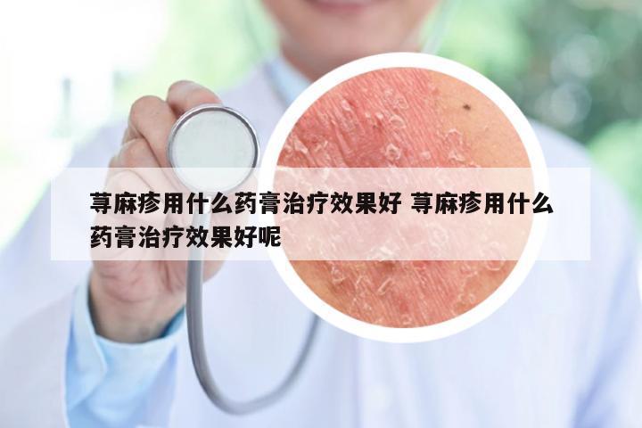 荨麻疹用什么药膏治疗效果好 荨麻疹用什么药膏治疗效果好呢