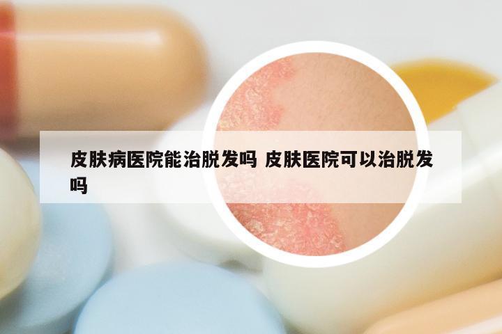 皮肤病医院能治脱发吗 皮肤医院可以治脱发吗