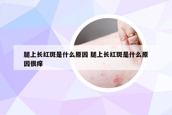 腿上长红斑是什么原因 腿上长红斑是什么原因很痒