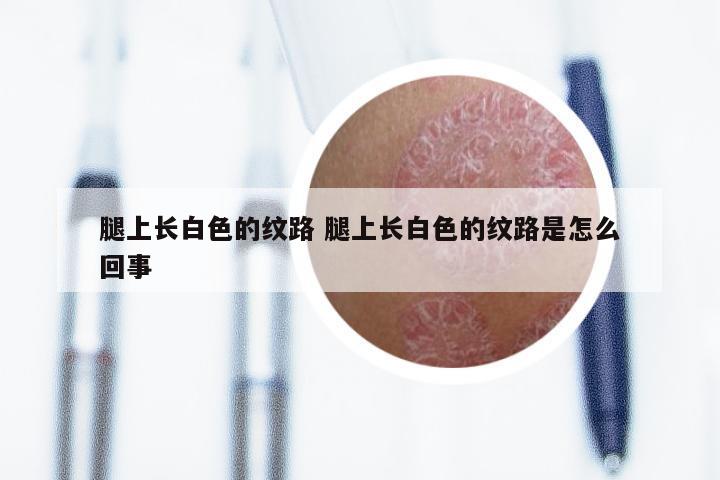 腿上长白色的纹路 腿上长白色的纹路是怎么回事