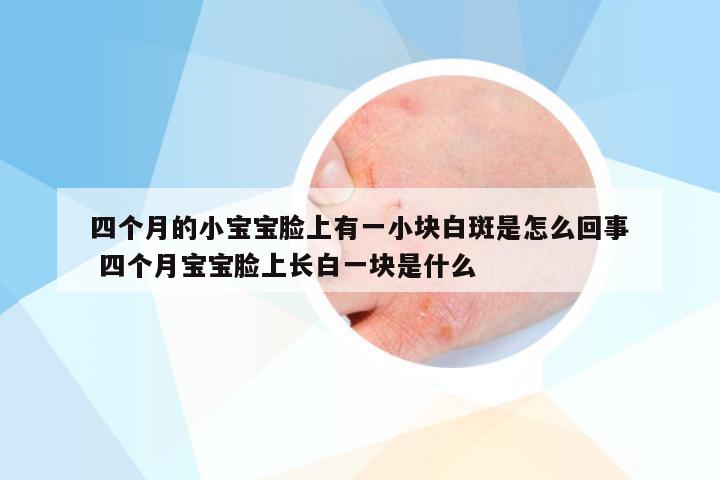 四个月的小宝宝脸上有一小块白斑是怎么回事 四个月宝宝脸上长白一块是什么