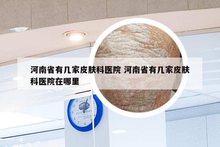 河南省有几家皮肤科医院 河南省有几家皮肤科医院在哪里