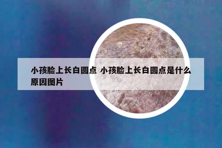 小孩脸上长白圆点 小孩脸上长白圆点是什么原因图片