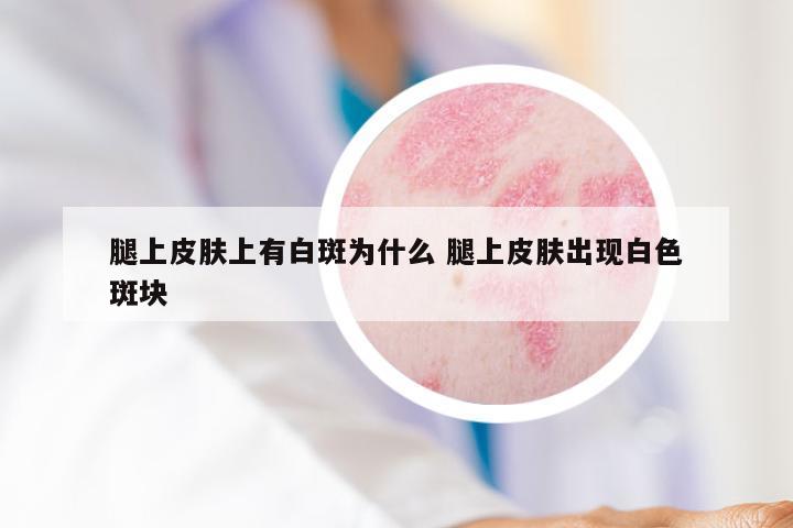 腿上皮肤上有白斑为什么 腿上皮肤出现白色斑块