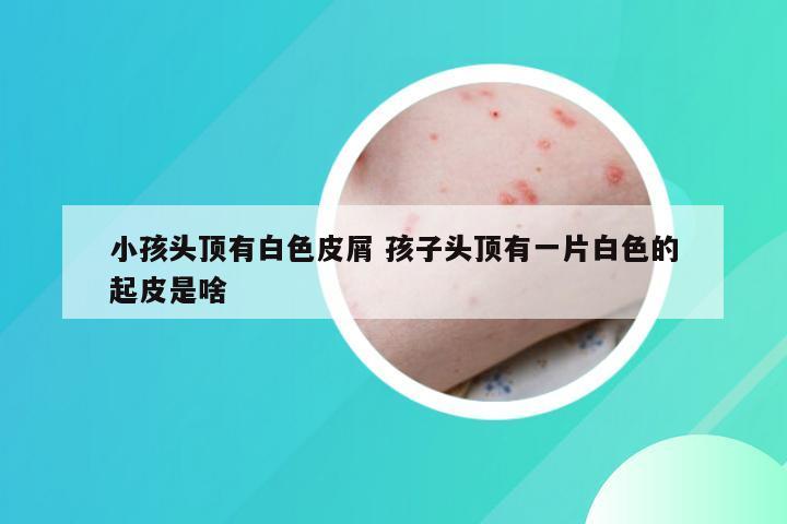 小孩头顶有白色皮屑 孩子头顶有一片白色的起皮是啥