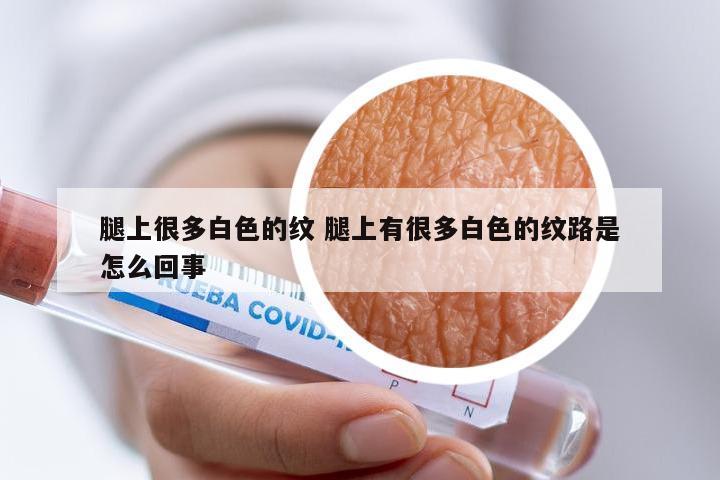 腿上很多白色的纹 腿上有很多白色的纹路是怎么回事